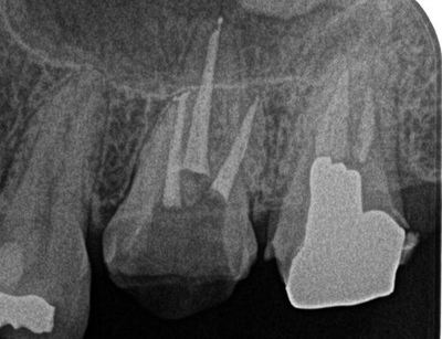 2014.03.17 2R78.jpg